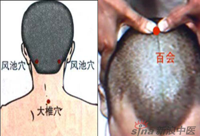常見(jiàn)病艾灸時(shí)怎樣選穴？--大椎百會(huì )穴