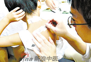 灸法的種類(lèi)  你知道多少？