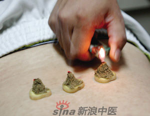 灸法的種類(lèi)  你知道多少？