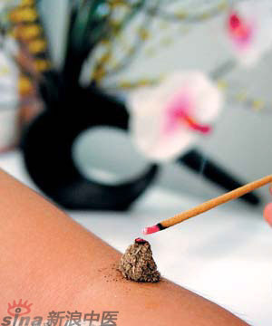 節氣灸” 冬至，你灸了嗎？